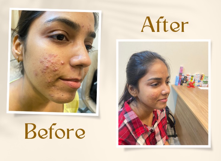 7ee0d930 8467 41ae B8f8 626ce03449ad