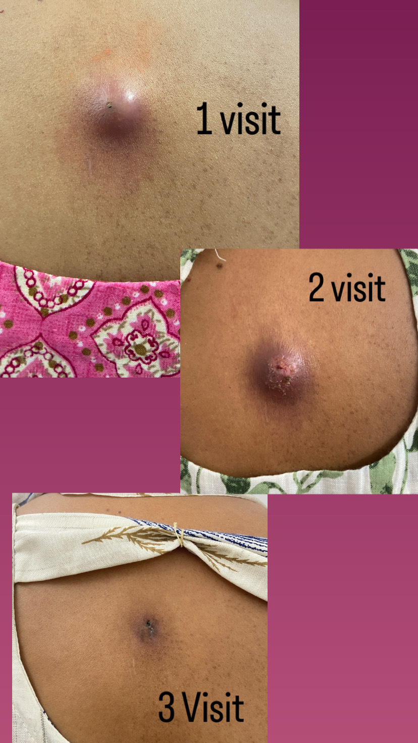 9942B191 9AEF 48D4 9525 7175406FA095