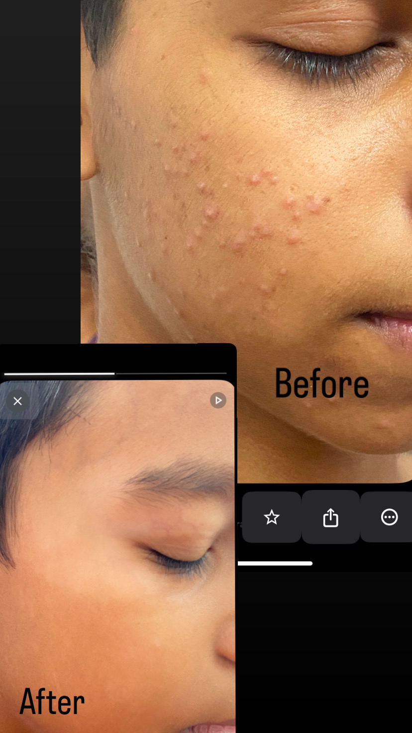 99A164BE E8B7 4DEC B451 E44E91C4C802